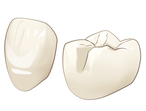 保険外の「セラミッククラウン」